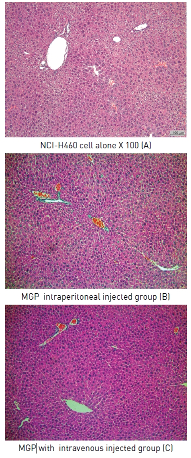 Gross finding of liver of NCI-H460 cells-bearingmice with positive control