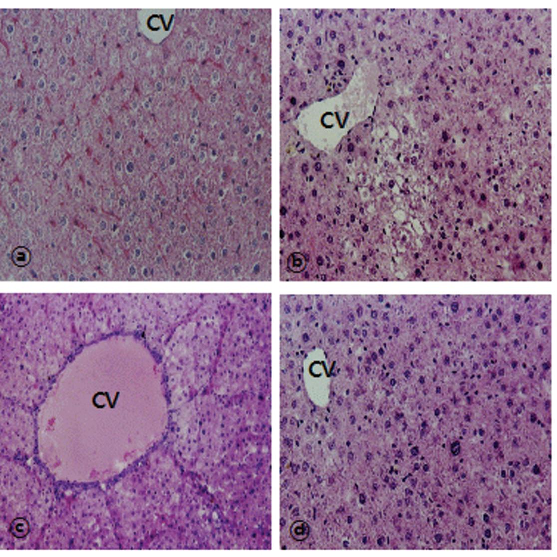 Histological sections of liver of rats in response to BH extract and DENA treatment.
