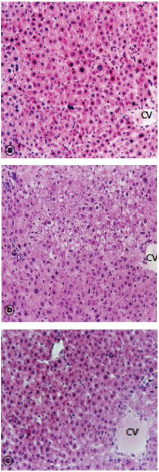 Histological sections of liver of rats in response to BH extract and DENA treatment.