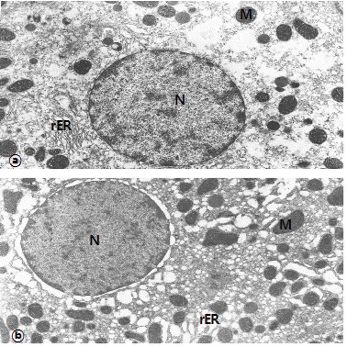 Electron micrograph of hepatocytes from the8(A) or 12 weeks(B) control rats.