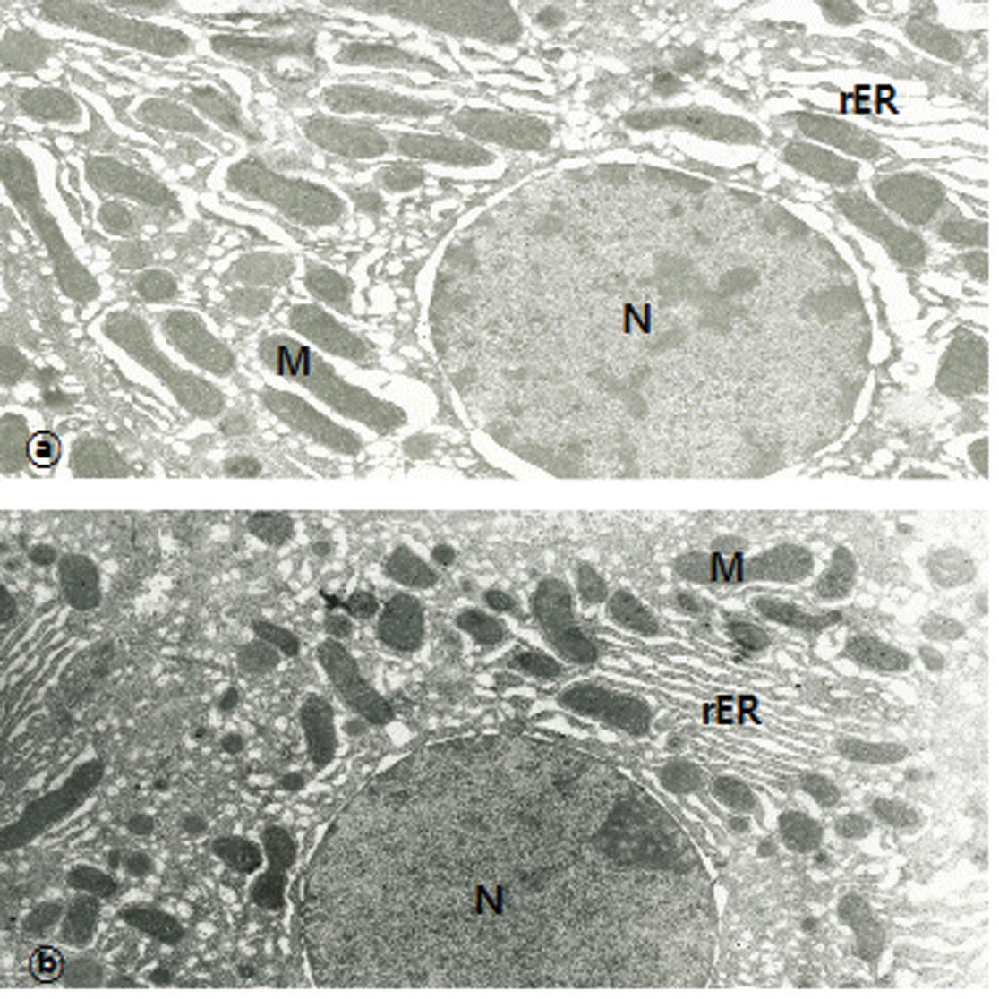 Electron micrograph of hepatocytes from theBHA-8(A) and BHB-8 group.
