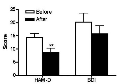 Comparisons of depression scale between beforeand after HHT-PA treatments. Error bar representsstandard error. **; p< .05. HAM-D; HamiltonDepression Rating Scale, BDI; Beckman DepressionIndex, Before; Group before HHT-PA, After; Groupbefore HHT-PA.