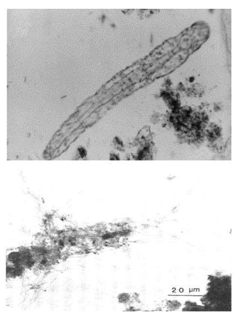 photograph of Aeolosoma genus microorganism and Haliscomenobacter hydrossis that generated in Pilot plant