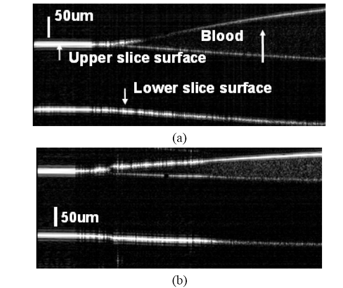 OCT images of blood layer on the surface of a glass slide: (a) SO2 = 100%; (b) SO2 = 0.
