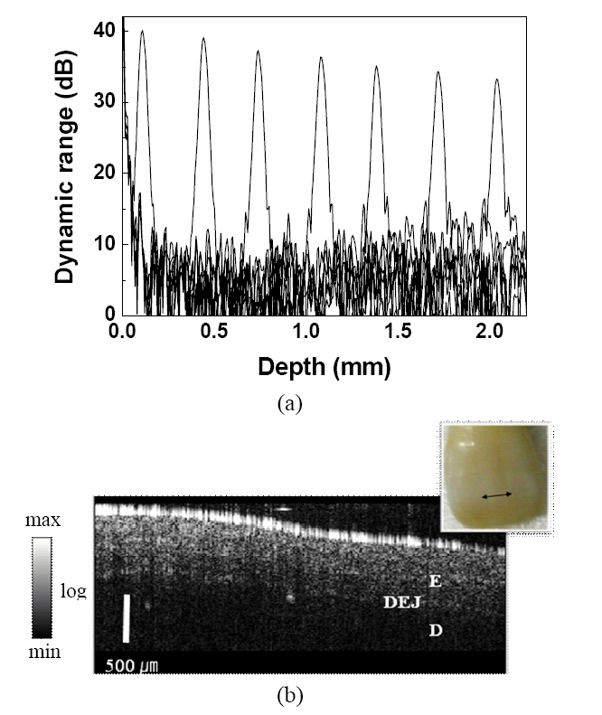 (a) Measured axial point spread functions at variousoptical-length differences. (b) OCT image of a human toothsample. The brighter regions correspond to the areas with alarger backscattered intensity (unit: dB). A picture of thesample surface is shown in the inset. The double-headedarrow indicates the sample’s scan range for the OCT image.Abbreviations: E, enamel; D, dentin; DEJ, dentoepithelialjunction.