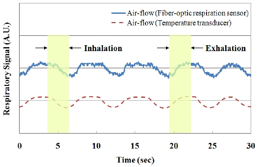 Comparison of the respiratory signal of a nasal-cavity attached fiber-optic respiration sensor and a temperature transducer.