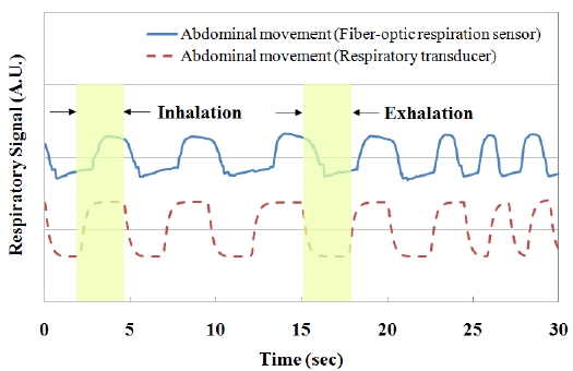Comparison of the respiratory signal of an abdomen attached fiber-optic respiration sensor and a respiration transducer.