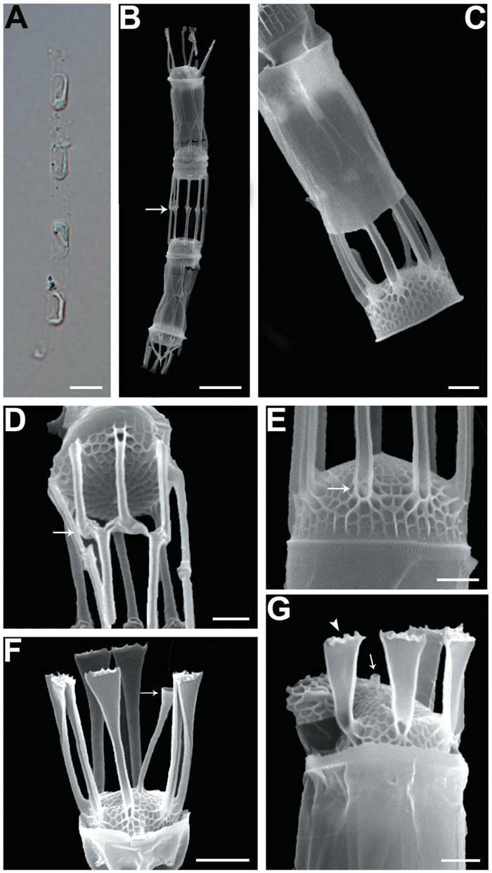 Skeletonema dohrnii. Light microscopy (A); Scanning electron microscopy (B-G). (A) Colony in girdle view. (B) Colony in girdleview connected with the the intercalary FPs (IFPs) (arrow). (C) Scale-covered the IFPs. (D) Intercalary valves with IFPs joined ina 1 : 1 or 1 : 2 fashion (arrow). (E) Convex valve view with loculate areolae. Note the IFPs entirely split and open at their base(arrow). (F) Terminal valve with the long and tubular terminal rimoportula process (arrow). (G) Short IFPP (arrow) and theflared tips and jagged margins of IFPs (arrowhead). Scale bars: A = 20 μm; B = 5 μm; C, D, E, G = 1 μm; F = 2 μm.