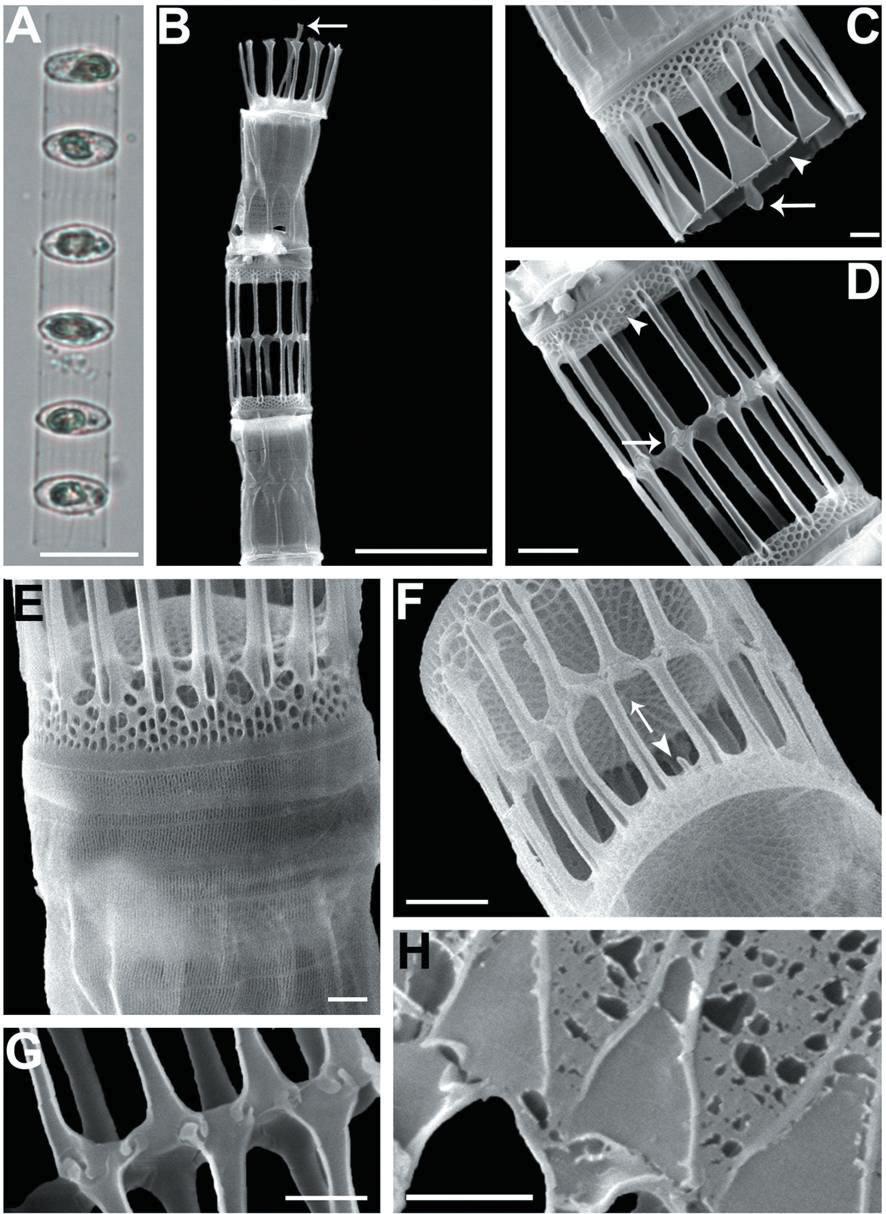 Skeletonema marinoi. Light microscopy (A); Scanning electron microscopy (B-H). (A) Colony in girdle view. (B) Colony in girdleview connected with the intercalary FPs (IFPs) and the terminal rimoportula process (TRP) (arrow). (C) The TRP (arrow) and flatand flared tips of the terminal FPs (arrowhead) in convex valve view. (D, F) Intercalary valves with 1 : 1 (arrow in Fig. D) or 1 : 2(Fig. F) IFP junctions and short the intercalary RP (arrowhead in Figs D, F). (E) Cingular band with rows of pores. (F) The tetragonalareolae distributed from the valve center. (G, H) Two IFP junctions of different forms. Scale bars: A , B = 10 μm; C, E, G, H =1 μm; D, F = 2 μm.
