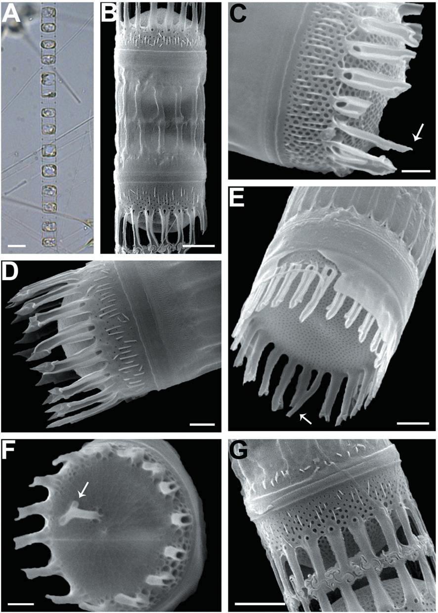 Skeletonema subsalsum. Light microscopy (A); Scanning electron microscopy (B-G). (A) Colony in girdle view. (B) Scale-coveredcolony in convex valve view connected with the intercalary FPs (IFPs). (C) The marginal long intercalary RP (IRP) (arrow) in theintercalary valve. (D) The pointed terminal FPs in convex valve view. (E) the marginal IRP (arrow) in the flat valve view. (F)Terminal valve with the subcentral hook-shaped terminal rimoportula process (arrow). (G) The intercalary valve with 1 : 1 shortIFP junctions. Scale bars: A = 20 μm, B, E, G = 2 μm, C, D, F = 1 μm.