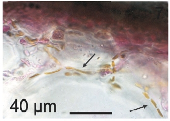 Transversal section of R. pseudopalmata showing endophytic filament of L. elsbetiae between both cortical and medullar regions (arrows).