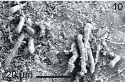 Photomicrograph under scanning electron microscopy (SEM) showing shorten filamentepiphytic L. elsbetiae on R. pseudopalmata’s surface.