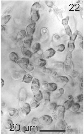 Detail of cells of gametophytic thalli.
