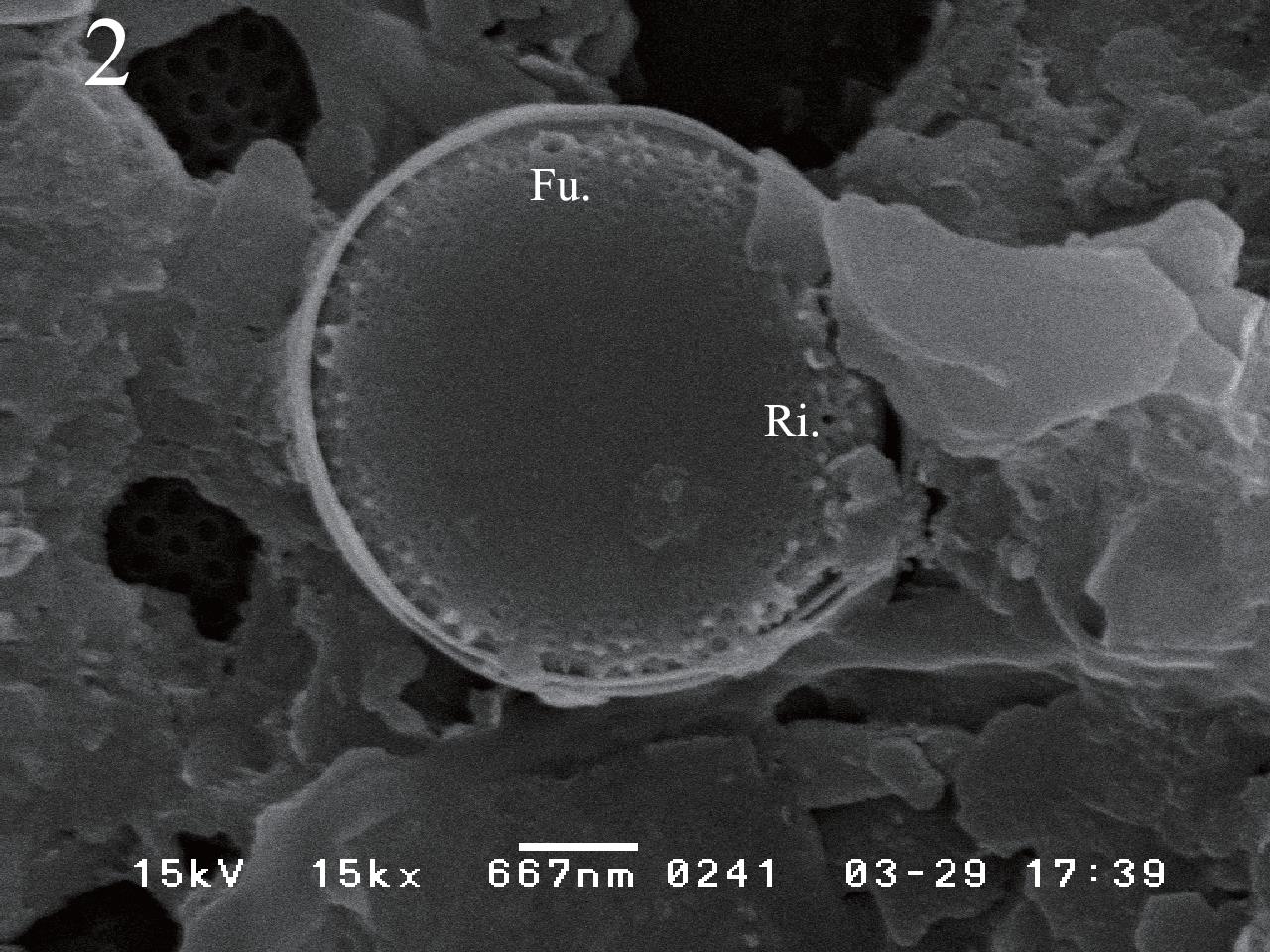 Cyclotella atomus var. marina SEM photos. Figs 2 & 3. External view, showing marginal fultoportula (Fu.) and rimoportula (Ri.).