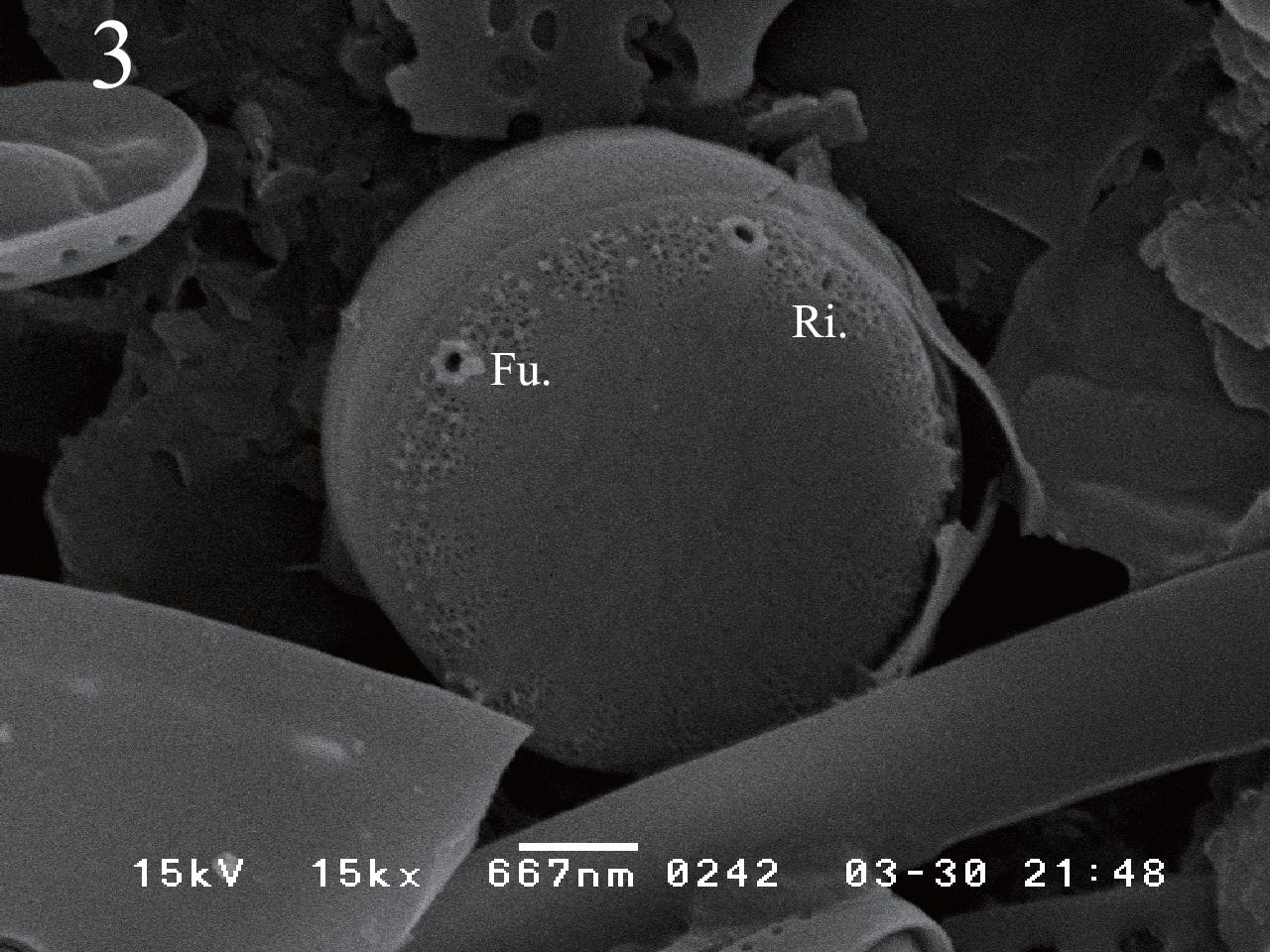 Cyclotella atomus var. marina SEM photos. Figs 2 & 3. External view, showing marginal fultoportula (Fu.) and rimoportula (Ri.)