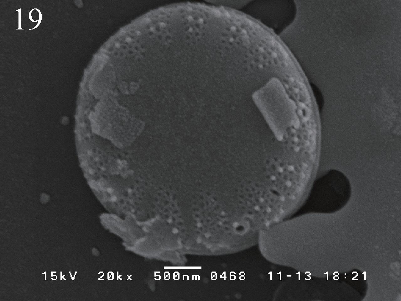 Cyclotella atomus var. marina SEM photos; showing various morphology of external valve. Each scale is shown in each photo.