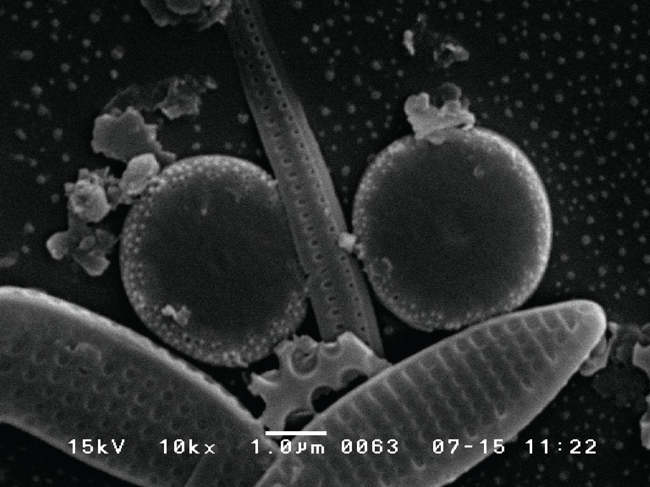 Cyclotella atomus var. marina SEM photos; showing various morphology of external valve. Each scale is shown in each photo.