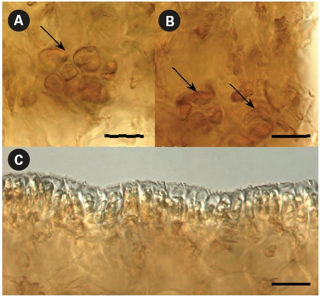Cross section of the blade. (A, B) Physodes (arrows). (C) Wavy reverse surface of blade, which did not have dark protuberances. Scale bars represent 10 μm.