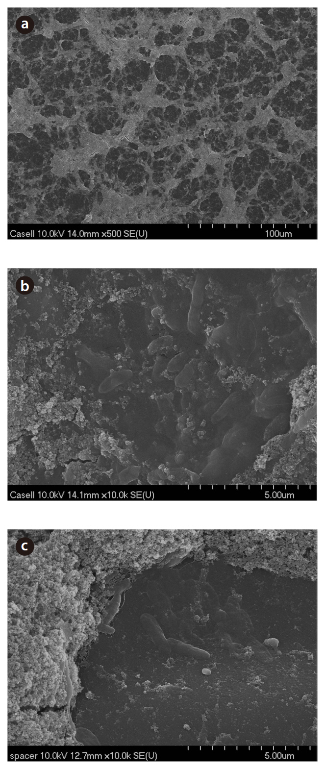 Scanning electron microscope images of the Case II biofilm. The surface image of the reverse osmosis (RO) membrane at lowermagnification (a) bacteria colonized in the biofilm matrix on the RO membrane (b) and bacteria on the spacer (c).