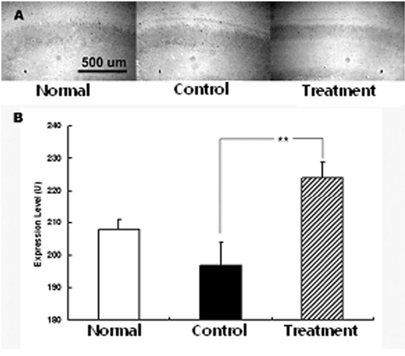 The effect of intravenous injection of Angelica extract water on c-Fos expression in the MCAO rats. c-Fos expression in cortical layers was decreased after MCAO  and increased with intravenous injection of Angelica water extract representing darker staining (A). The expression was measured from coronal sections of the rat and converted into graphs (B). Intravenous injection of Angelica extract water increased c-Fos expression significantly compared with Control. Data show mean and standard deviation between Control and Treatment group with significant difference. ** p<0.01. Scale bar= 500 ㎛
