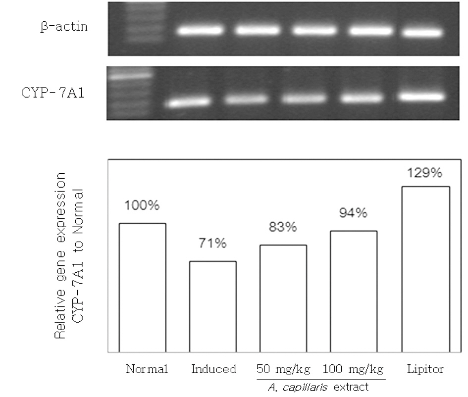 CYP-7A1 gene expression in liver tissue.