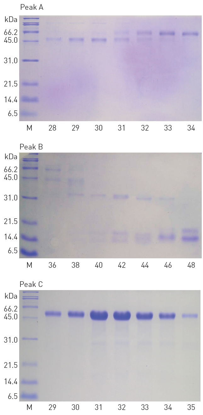 SDS-PAGE of the fibrinolytic fractions obtained from Sephadex G-75 column chromatography (Fig. 2) of the peaks A B and C which are obtained from Q-Sepharose column chromatography (Fig. 1) of G. b. siniticus venom. M Molecular weight markers; The lane numbers correspond to the fraction numbers of the chromatography in Fig. 2. Molecular weight markers are listed in SDS-PAGE of Materials and Methods.