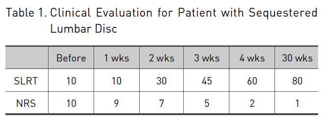 Clinical Evaluation for Patient with Sequestered Lumbar Disc