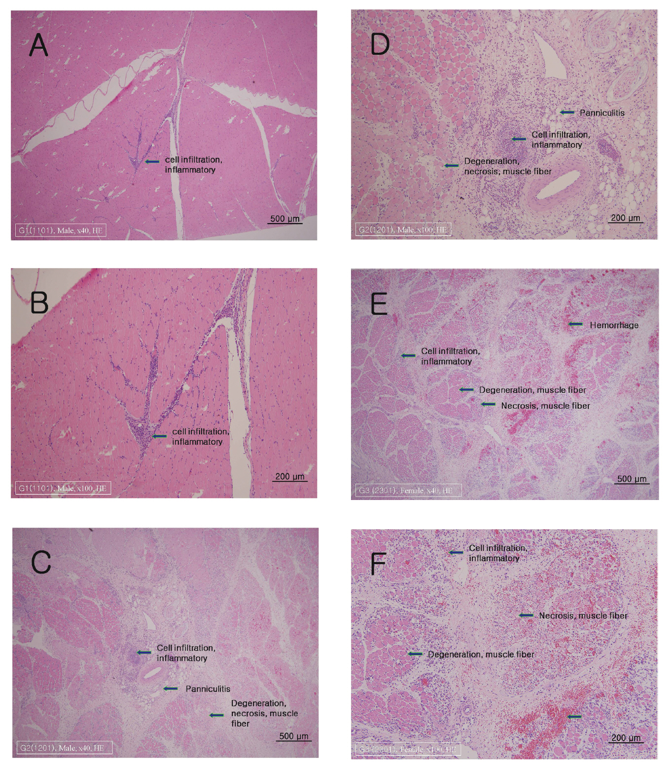 The tissue of thigh muscle from four week repeated dose toxic test of Sweet Bee Venom(melittin) in Beagle dogs. Control group showed that focal cell infiltration was appeared due to needle stimulation(A & B). In the low dosage group(treated with 0.14 ㎎/㎏ every day during 28 days) was shown changes of degeneration fibrosisinflammatory panniculitis and necrosis of muscle fiber(C & D).In the high dosage group(treated with 0.56 ㎎/㎏ every day during 28 days) was shown severe changes of degeneration fibrosis inflammatory hemorrhage and necrosis of muscle fiber(C & D) compared to the low dosage group. These results showed that Sweet Bee Venom has influenced to the muscle fiber under the dose dependence. Pathological change was detected by Hematoxylin & Eosin (H&E) staining(×40(A C E) ×100(B D F)).