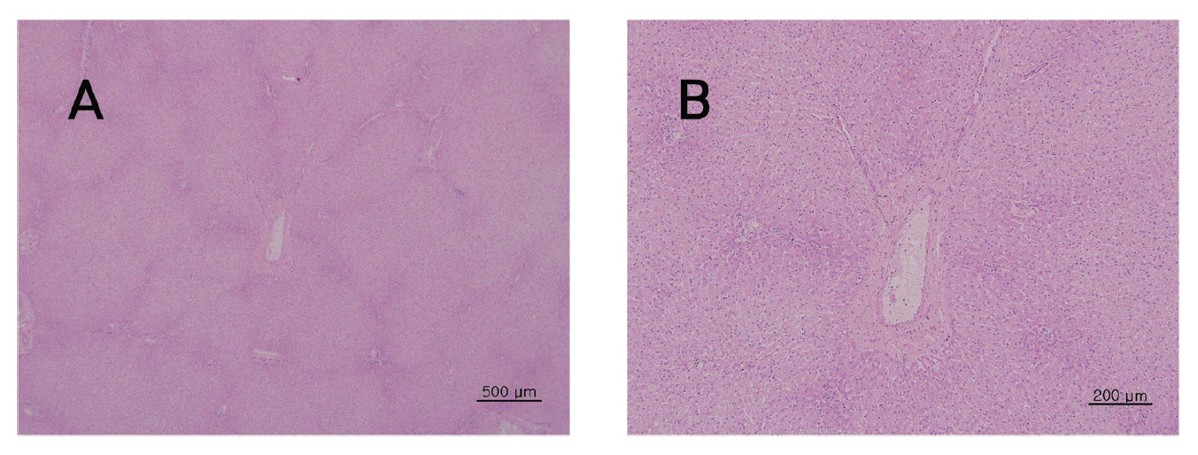 The tissue of liver from four week repeated dose toxic test of Sweet Bee Venom in Beagle dogs. There were not detected in any abnormalities compared with control group. Beagle dogs were treated three times with 14 ㎎/㎏ dose(1 3 and 9 ㎎/㎏) of Sweet Bee Venom but pathological changes were not observed in Hematoxylin& Eosin (H-E) staining(A×40 B×100).