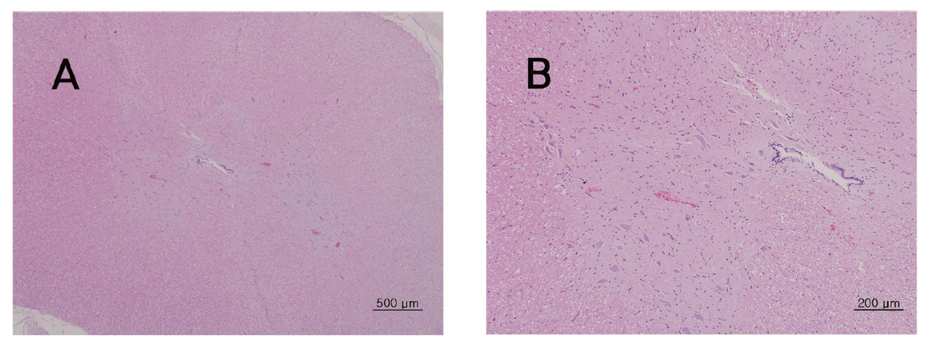 The tissue of spinal cord from four week repeated dose toxic test of Sweet Bee Venom in Beagle dogs. There were not detected in any abnormalities compared with control group. Beagle dogs were treated three times with 14 ㎎/㎏ dose(1 3 and 9 ㎎/㎏) of Sweet Bee Venom but pathological changes were not observed in Hematoxylin & Eosin (H-E) staining(A×40 B×100).