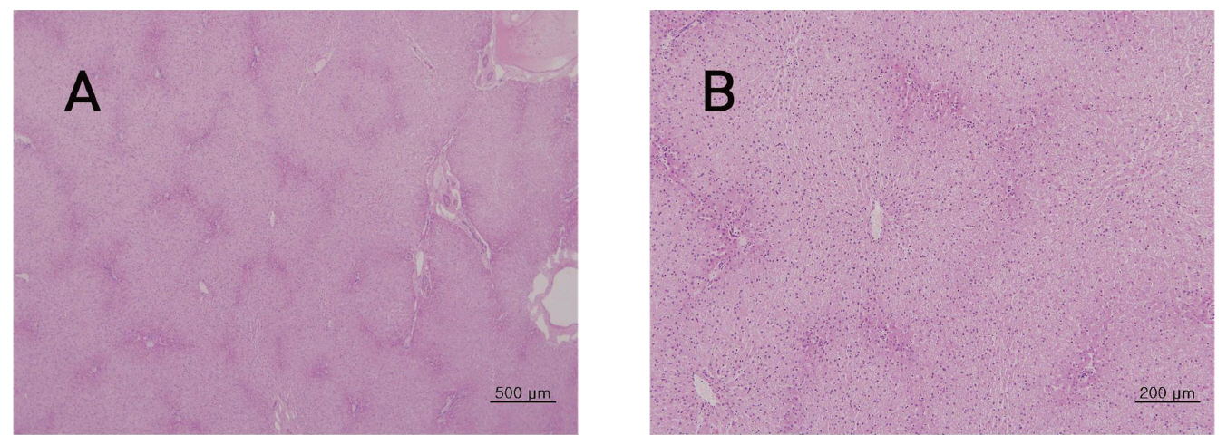 The tissue of liver from single dose toxic test of Sweet Bee Venom in Beagle dogs. There were not detected in any abnormalities compared with control group. Beagle dogs were treated three times with 14 ㎎/㎏ dose(1 3 and 9 ㎎/㎏) of Sweet Bee Venom but pathological changes were not observed in Hematoxylin & Eosin (H-E) staining(A×40 B×100).