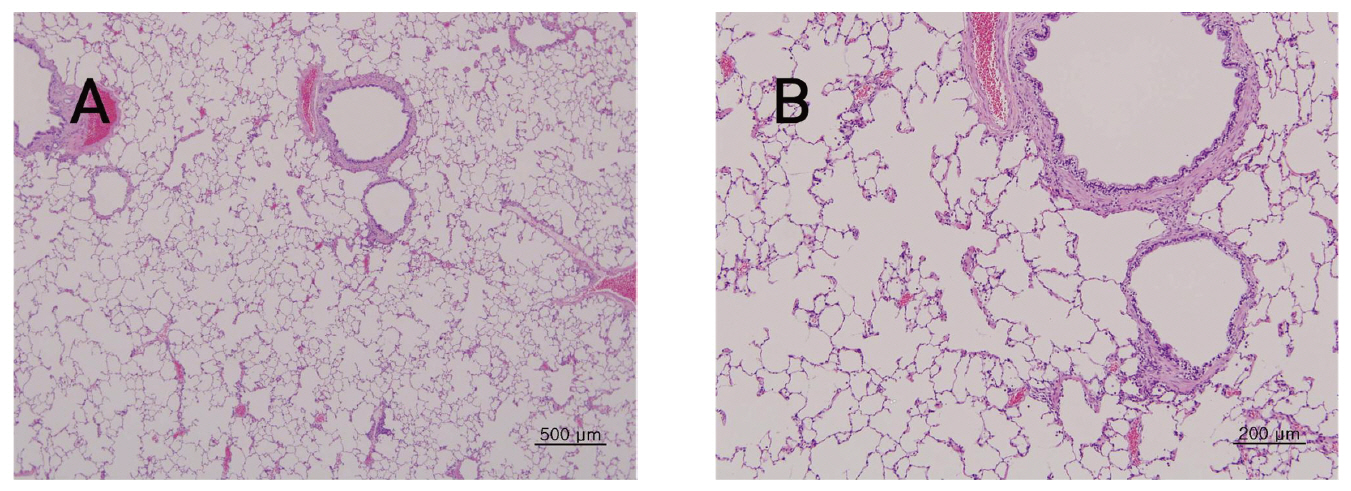 The tissue of lung from single dose toxic test of Sweet Bee Venom in Beagle dogs. There were not detected in any abnormalities compared with control group. Beagle dogs were treated three times with 14 ㎎/㎏ dose(1 3 and 9 ㎎/㎏) of Sweet Bee Venom but pathological changes were not observed in Hematoxylin & Eosin (H-E) staining(A×40 B×100). .