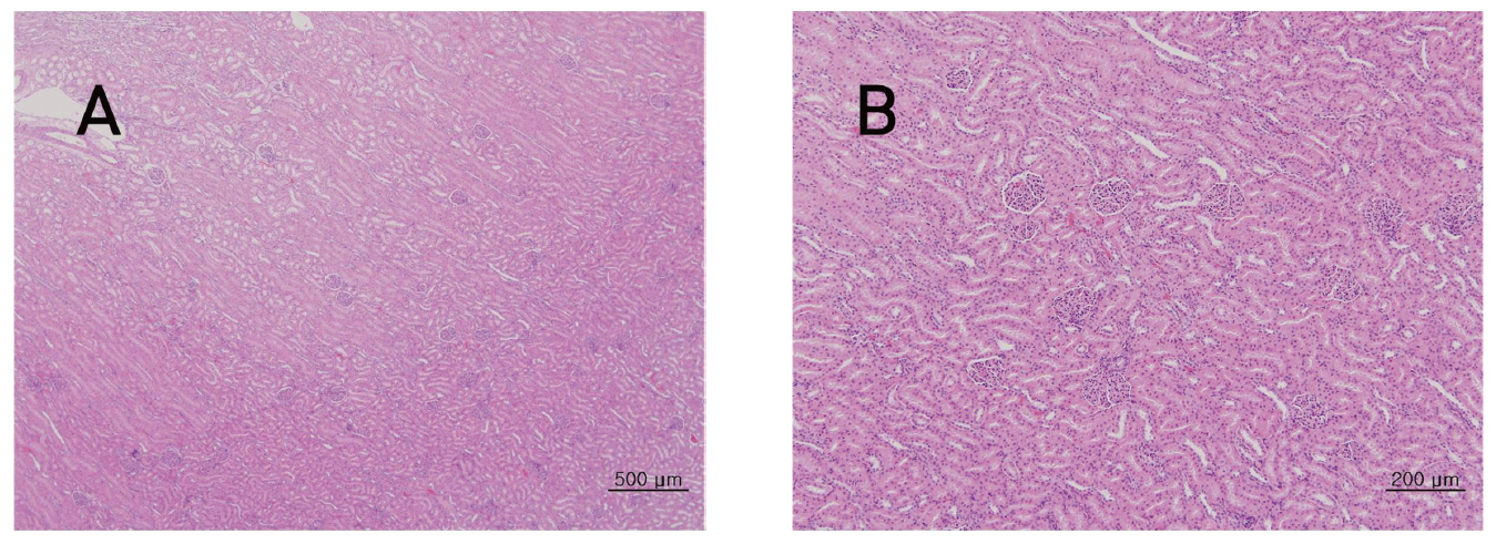 The tissue of kidney from single dose toxic test of Sweet Bee Venom in Beagle dogs. There were not detected in any abnormalities compared with control group. Beagle dogs were treated three times with 14 ㎎/㎏ dose(1 3 and 9 ㎎/㎏) of Sweet Bee Venom but pathological changes were not observed in Hematoxylin & Eosin (H-E) staining(A×40 B×100).