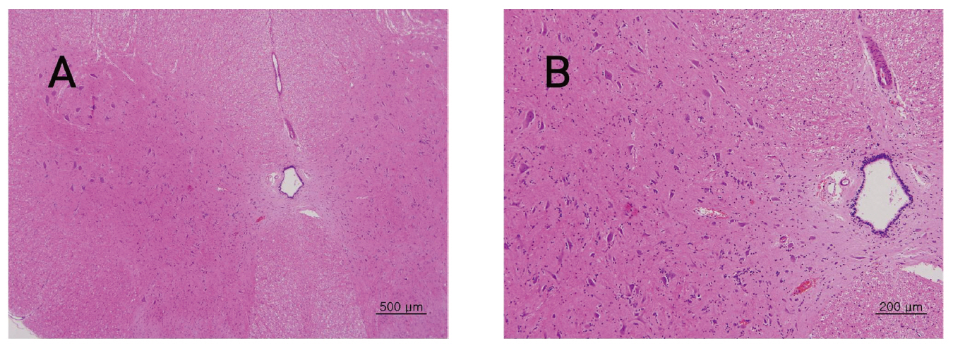 The tissue of spinal cord from single dose toxic test of Sweet Bee Venom in Beagle dogs. There were not detected in any abnormalities compared with control group. Beagle dogs were treated three times with 14 ㎎/㎏ dose(1 3 and 9 ㎎/㎏) of Sweet Bee Venom but pathological changes were not observed in Hematoxylin & Eosin (H-E) staining(A×40 B×100).