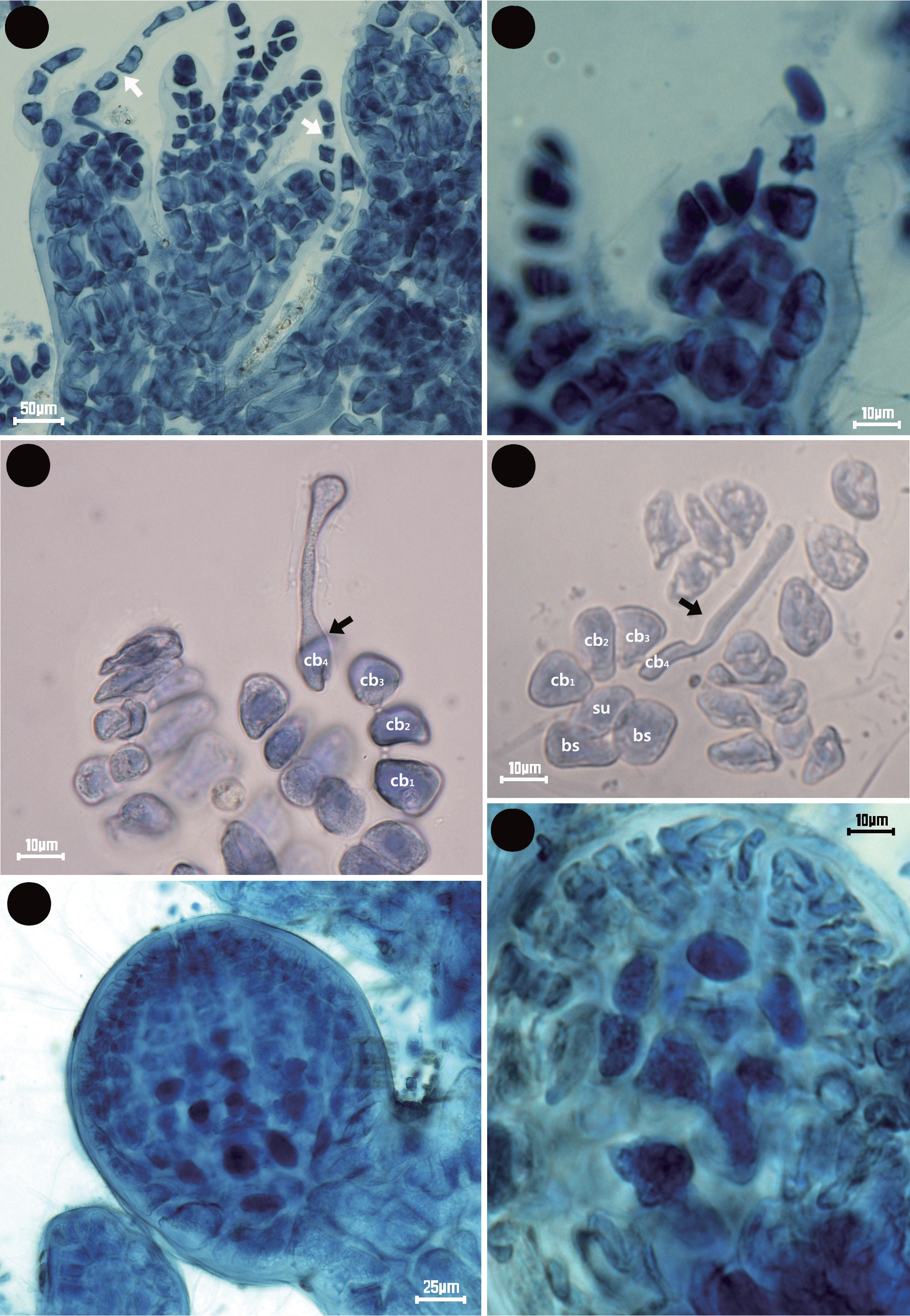 Symphyocolax koreana gen. et sp. nov. (A) Thallus showing procarps with trichoblast (arrows). (B-D) Carpogonial branch four-celled with two basal sterile cells and protruding trichogynes (arrows). (E & F) Gonimoblast in young cystocarp. bs basal sterile cell; cb carpogonial branch with cell numbers; su supporting cell.