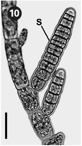 Branch with plurilocular sporangia (S). Scale bars represent: Fig. 8 0.5 mm; Fig. 9 100 μm; Fig. 10 40 μm.