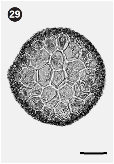 Cross section view of thallus. Scale bars represent: Fig. 25 1 mm; Fig. 26 0.5 mm; Fig. 27 0.5 mm; Fig. 28 1 mm; Fig. 29 50 μm.