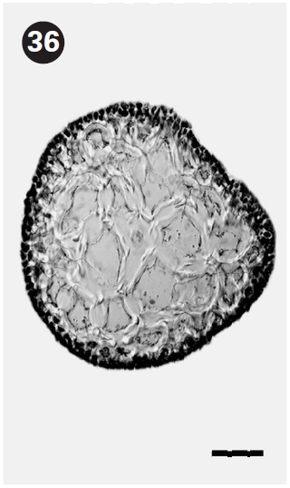 Cross section view of thallus. Scale bars represent: Fig. 34 1 mm; Fig. 35 0.5 mm; Fig. 36 50 μm.