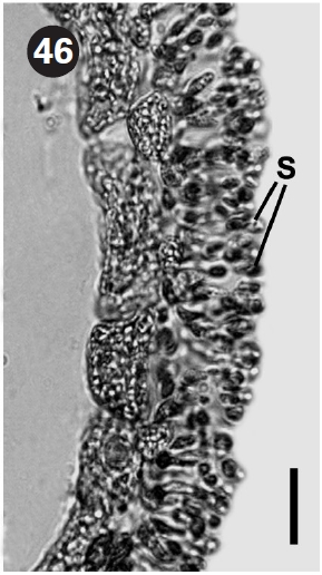 Cross section of male branch with spermatangia (S).