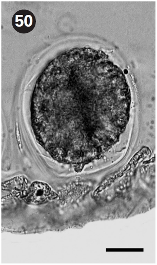 Cross section of tetrasporic thallus showing tetrasporangium developed from cortical cell. Scale bars represent: Fig. 37 1 mm; Fig. 38 40 μm; Fig. 39 50 μm; Fig. 40 50 μm; Fig. 41 100 μm; Fig. 42 50 μm; Fig. 43 20 μm; Fig. 44 0.5 mm; Fig. 45 40 μm; Fig. 46 40 μm; Fig. 47 100 μm; Fig. 48 100 μm; Fig. 49 100 μm; Fig. 50 20 μm.