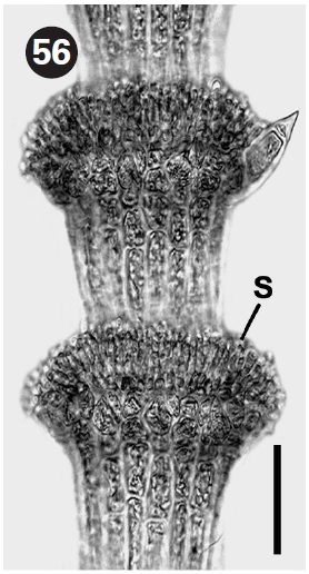 Cortical node with spermatangia (S) of male thallus