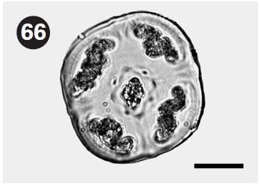 Cross section of thallus