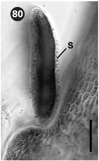 Spermatangial sorus with spermatangia (S).