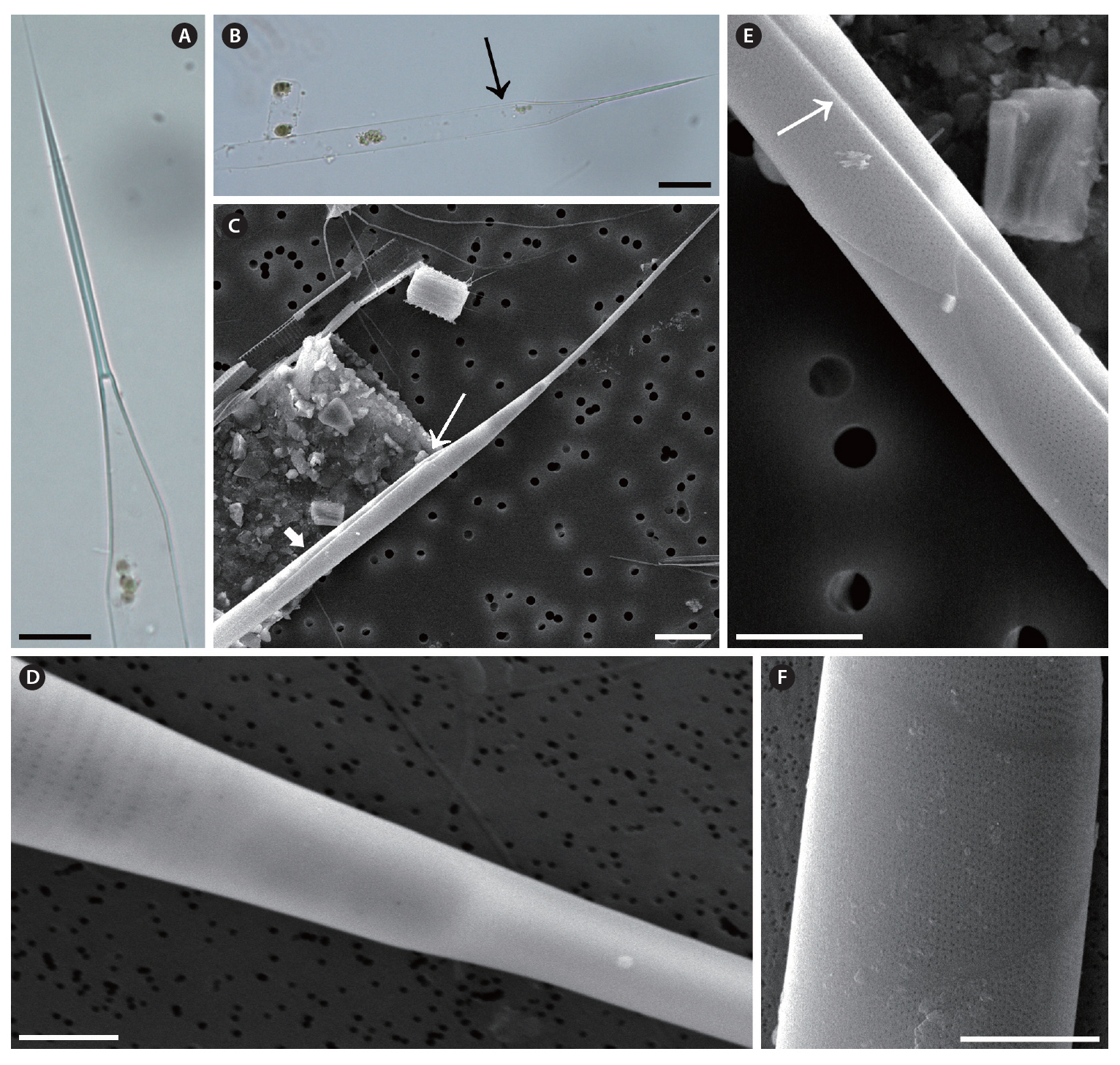 Rhizosolenia pungens. (A) Apical part of valve light microscopy (LM). (B) Apical part of valve with invisible clasper (arrow) LM. (C) Apical part of valve external process clasper (thin arrow) and thin groove shaped contiguous area (thick arrow) scanning electron microscopy (SEM). (D) Basal part of external process which lacks otaria SEM. (E) Thin groove-shaped contiguous area (arrow) SEM. (F) Detail of areola one of the narrow slit-shaped areolae in girdle segments SEM. Scale bars represent: A & C 10 ㎛; B 20 ㎛; D 2 ㎛; E & F 5 ㎛.