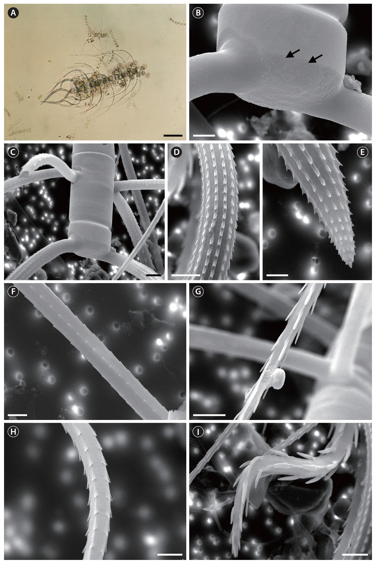 Chaetoceros coarctatus (A light microscope; B-I scanning electron microscope). (A) Part of a chain showing the terminal intercalary setae and attached species of Vorticella oceanica. (B) Posterior terminal valve with several rimoportula (arrows). (C) Part of a chain in broad girdle view absent foramina. (D) Middle part of terminal setae with very heavily silicified spines. (E) Tip of tapering terminal setae with robust spines. (F) Region of between original and middle part of common intercalary setae with weak spines. (G) Straight common intercalary setae with heavily spines. (H) Middle part of special intercalary setae with regular poroids and spines. (I) Heavily curved special intercalary setae with very robust spines. Scale bars represent: A 100 ㎛; B E F & H 5 ㎛; C D G & I 10 ㎛.