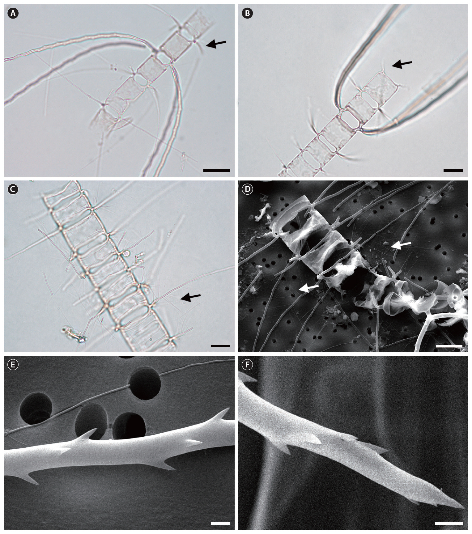 Chaetoceros compressus var. hirtisetus (A-C light microscope; D-F scanning electron microscope). (A) Partial colony with special and common intercalary setae which have thin fine capilli (arrow). (B) Partial colony in broad girdle view showing shapes of foramina and terminal setae (arrow). (C & D) Common intercalary setae with thin fine capilli (arrows). (E) Special intercalary setae with spiral spines. (F) Tip of tapering special intercalary setae with spiral spines. Scale bars represent: A-D 10 ㎛; E & F 1 ㎛.