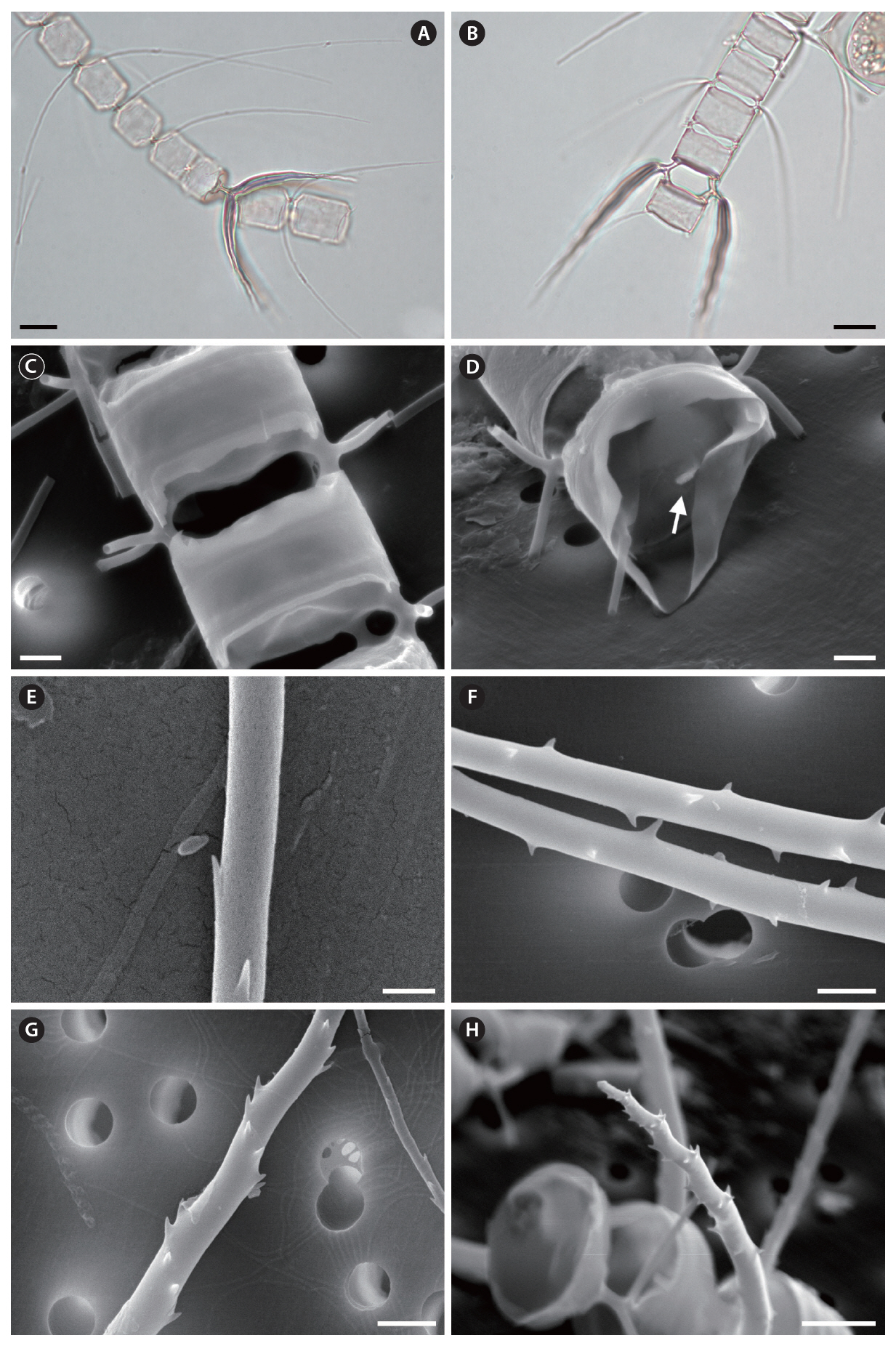 Chaetoceros contortus (A & B light microscope; C-H scanning electron microscope). (A) Part of a chain in narrow girdle view showing common and special intercalary setae. (B & C) Part of a chain in broad girdle view showing shapes of foramina. (D) Rimoportula located on the center of the terminal valve (arrow). (E) Common intercalary setae with spines. (F) Original region of special intercalary setae with irregular spines. (G) Special intercalary setae with heavily silicified spines in spirals. (H) Tip of tapering special intercalary seta with spines in spirals. Scale bars represent: A & B 10 ㎛; C D F & G 2 ㎛; E 0.5 ㎛; H 5 ㎛.