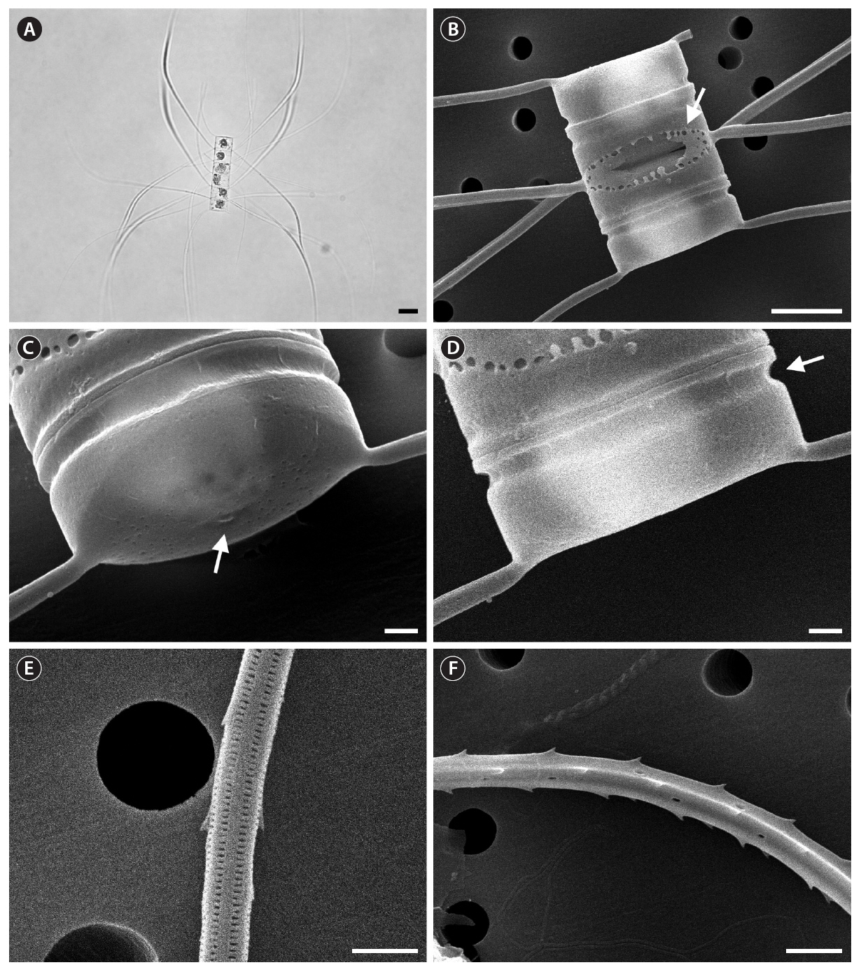 Chaetoceros diversus (A light microscope; B-F scanning electron microscope). (A) Five-celled chain with terminal common intercalary and special intercalary setae and 1 chloroplast per cell. (B) Two-celled colony having small poroids on mantles and absent or quite narrow foramina. (C) Rimoportula (arrow) within small depression at center of terminal valve. (D) Constricted valve mantle (arrow) and flat valve surface. (E) Common intercalary setae with slitted poroids and fine spines. (F) Special intercalary setae with relatively few poroids and strong spines. Scale bars represent: A 10 ㎛; B 5 ㎛; C-E 1 ㎛; F 2 ㎛.