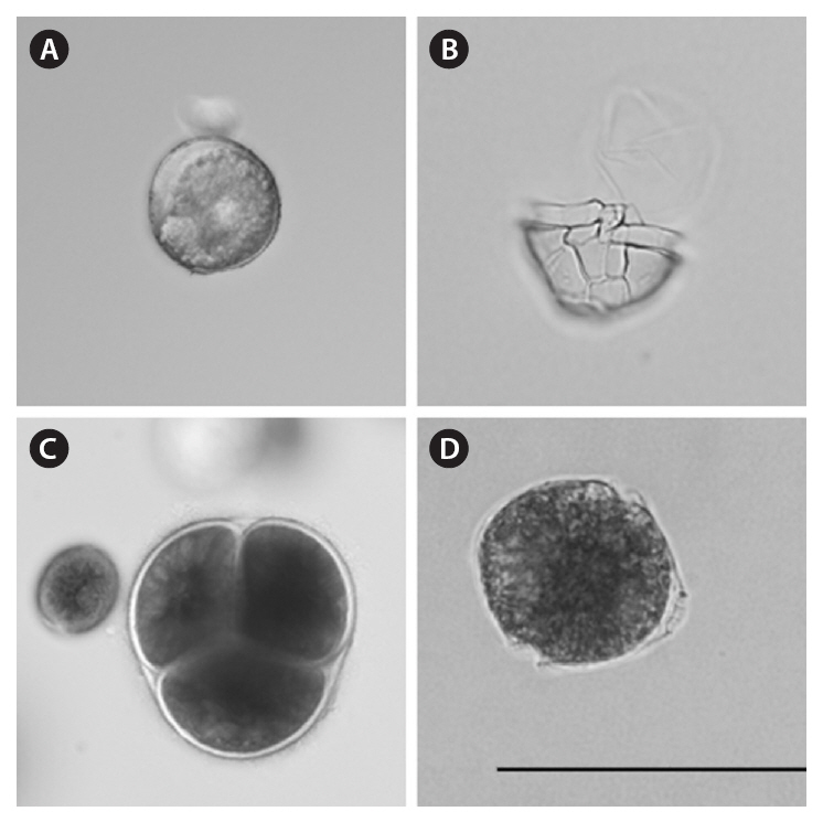 Examples of light micrographs used to identify cysts and vegetative cells for this study. (A) Alexandrium balechii cyst. (B) Hypotheca of A. balechii showing the diagnostic sulcal plates. (C) Cyst cluster of a peridinoid dinoflagellate. (D) Vegetative cell of the peridinoid dinoflagellate with characteristic apical pore complex. Scale bar represent: 40 ㎛.