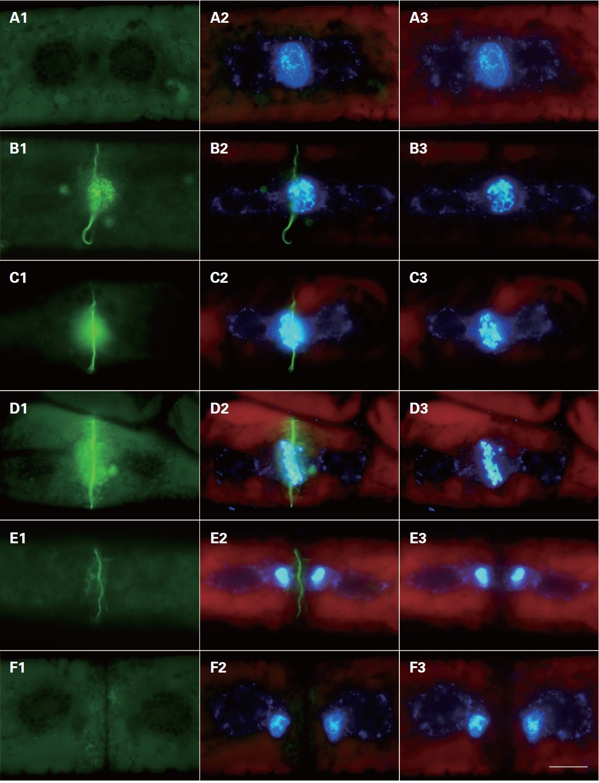 Phallacidin staining of Zygnema cruciatum actin during cell division. (A) Interphase. (B) Prophase. (C) Prometaphase. (D) Metaphase. (E) Anaphase. (F) Telophase. (A1-F1) Phallacidin stained actin filaments. (A2-F2) Merged pictures of Phallacidin stained actin filaments and DAPI stained nucleus. (A3-F3) DAPI stained nuclei. Scale bar represents: 10 ㎛.